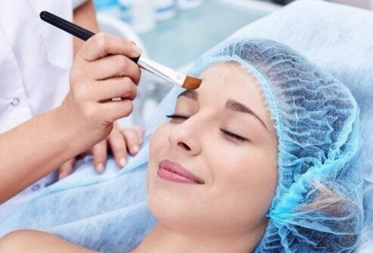 Иплин. Пилинг для лица. Химический пилинг. Кто делал пилинги. Кто делал пилинги.